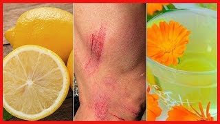 7 remedios naturales para curar rasguños en la piel [upl. by Yelraf]