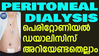 Peritoneal Dialysis details in malayalam  peritoneal dialysis treatment [upl. by Kloster498]