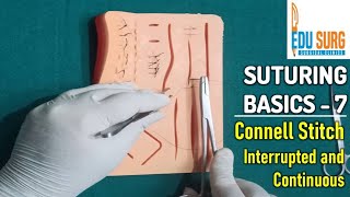 Intestinal anastomosis l Connell Stitch l OSCE skill stations part 7 l Surgical clinics [upl. by Valencia]