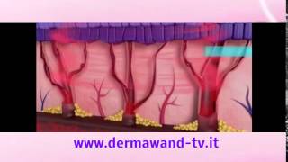 Dermawand video ufficiale [upl. by Rosemonde727]