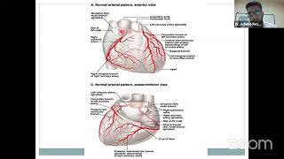 Les cardiopathie ischémique dr rezzoug  cours de cardiologie  4eme année medecine [upl. by Ahsetra]