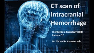 CT of intracranial hemorrhage Highlights in Radiology HIR episode 12 [upl. by Drofnelg]