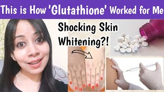 Glutathione Works for Skin Whitening For Tan removal Pigmentations Glutathione before and after [upl. by Ymerrej]