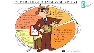 Pharmacology of Peptic Ulcer Disease [upl. by Armand]