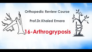 16Arthrogryposis prof Dr Khaled Emara تشوه الاطراف مرض ارثروجرايبوسس  أد خالد عمارة [upl. by Martguerita]