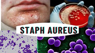 Staphylococcus aureus  staphylococcus infection  causes symptoms [upl. by Llerrut964]