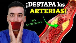 DESTAPA LAS ARTERIAS ¡SIN REMEDIOS [upl. by Ahsain]