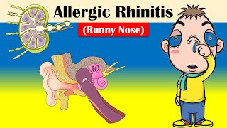 Allergic Rhinitis Runny Nose  Causes Triggering Factors Signs amp Symptoms And Treatment [upl. by Gideon69]