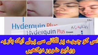 Hydroquinone plus creamhydroquinone creamhydroquinhydroquinone cream before and afterSide effect [upl. by Bijan]