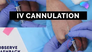 Intravenous IV cannulation  OSCE Guide  UKMLA  CPSA [upl. by Landers298]