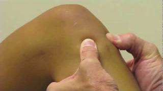 ACL Exam Lachmans Test Pivot Shift Drawer Test performed by Dr Eric Janssen [upl. by Lorrin100]