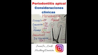 PERIODONTITIS APICAL consideraciones [upl. by Clarance]