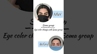 eye color change surgery keratopigmentation اكسبلور جميل colourfuleyes eyetest [upl. by Nrojb741]