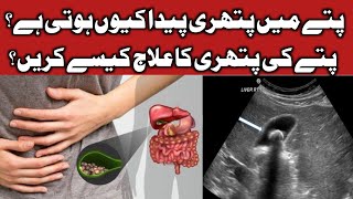 Gallstone symptoms and treatment in urdu  Dr Saif Ur Rehman [upl. by Enawd525]