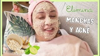 MASCARILLA DE AVENA Y LIMON  Aclara y elimina el acnè en tu rostro [upl. by Pfeifer]