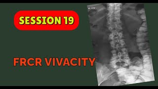 FRCR VIVACITY SESSION 19 [upl. by Frasch]