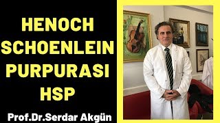 Henoch Schonlein Purpurası HSP Serdar Akgün [upl. by Ahsienek]