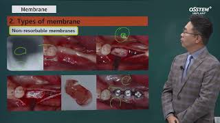 Master course SURGERY Membrane [upl. by Steinway512]