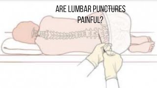 Lumbar Puncture experience [upl. by Salomie372]