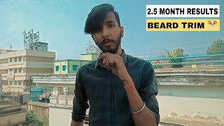 25 months minoxidil results 👤 Trimming my beard 😗 how to grow beard minoxidil beard 👀😱 [upl. by Enrichetta]