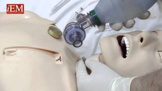 Simple Needle Cricothyroidotomy Options [upl. by Amme]