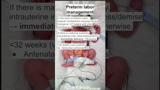 Preterm labor management [upl. by Oijile]