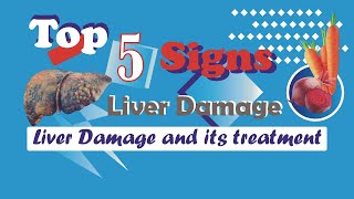 Signs of LIVER Damage and its Treatment with Beetroot and Carrot  LIVER Detox [upl. by Rojam]