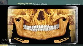 Estructuras anatómicas en la radiografía panorámica [upl. by Aihsekat]