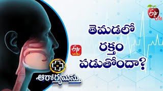 Hemoptysis Blood In Sputum  తెమడలో రక్తం పడుతోందా  Aarogyamastu  14th Jan 2023  ETV Life [upl. by Nueormahc]