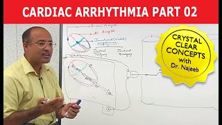 Cardiac Arrhythmia  Part 23 [upl. by Aynek]