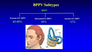 BPPV  Preliminary Insights [upl. by Rydder]