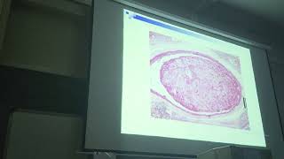 pathology practical thrombus [upl. by Kelwen]