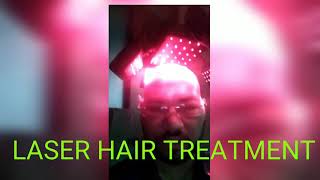 Laser lite hair treatment  Hair transplant day 3  Hair transplant in delhi [upl. by Collar]