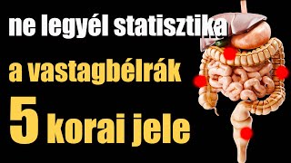 Ne kerülj a statisztikába ismerd meg a vastagbélrák 5 korai jelét [upl. by Belle877]