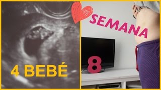 SEMANA 8 DE EMBARAZO BEBÉ 4 GINECÓLOGO Y ECOGRAFÍA  Sandra Ss [upl. by Marthena530]