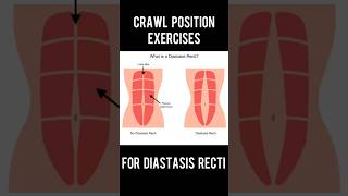 4 exercises for Diastasis Recti in crawl position Arogya physiotips diastasisrectiexercises [upl. by Anaujal417]