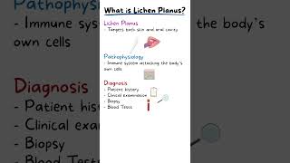 ORAL LICHEN PLANUS EXPLAINED [upl. by Price]