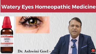 Watery Eyes Homeopathic Medicine By Dr Ashwini Goel [upl. by Sila]