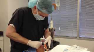 Quick amp Easy Bougie Port Intubation [upl. by Kinney]