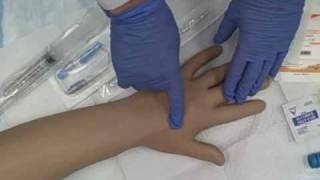 Intravenous IV Saline Lock Insertion [upl. by Eilsew]