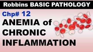 Ch12  Anemia of Chronic Inflammation  Blood Pathology  Dr Asif Lectures [upl. by Matthaus]