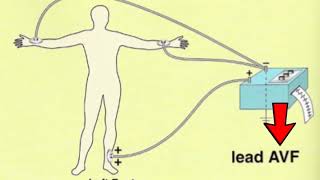 🔴 LES 12 DÉRIVATIONS ECG EXPLIQUÉES TRÈS CLAIREMENT  DR ASTUCE [upl. by Maryn]