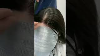 Receding hairline Dont miss this 🔥 Shop in description  Receding hairline patches [upl. by Alliuqet475]