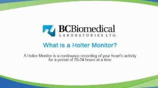 Reviewing the ECG of the Holter monitor [upl. by Kaye599]