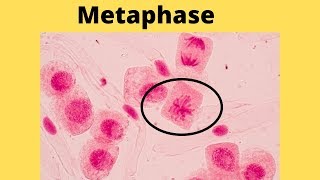 What happens during metaphase [upl. by Kimble]