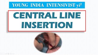 CENTRAL LINE IJV  CATHETER  INSERTION  courtesy NEJM [upl. by Atikin888]