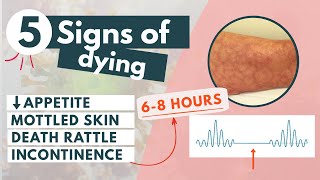 How to recognize a dying patient  5 signs of approaching death [upl. by Britta973]