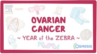 Ovarian cancer Year of the Zebra [upl. by Anibor983]