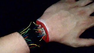 Disconnected Hand  Illusion Trick Art [upl. by Venterea74]