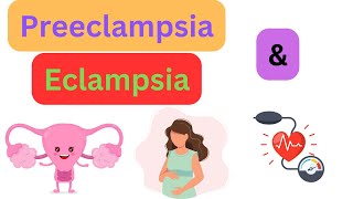 PreeclampsiaEclampsia  PANCE Board Review [upl. by Yrolg]